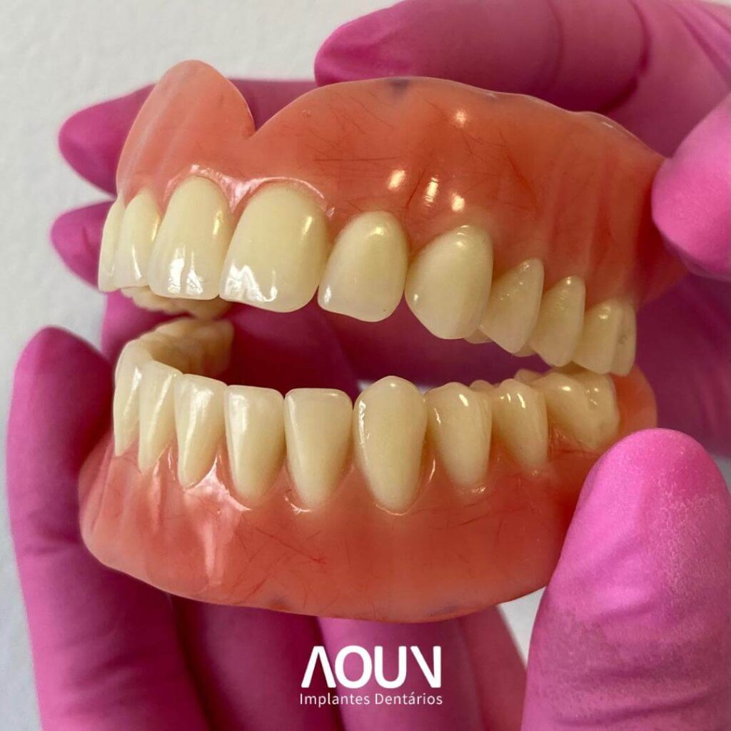Implante dentário