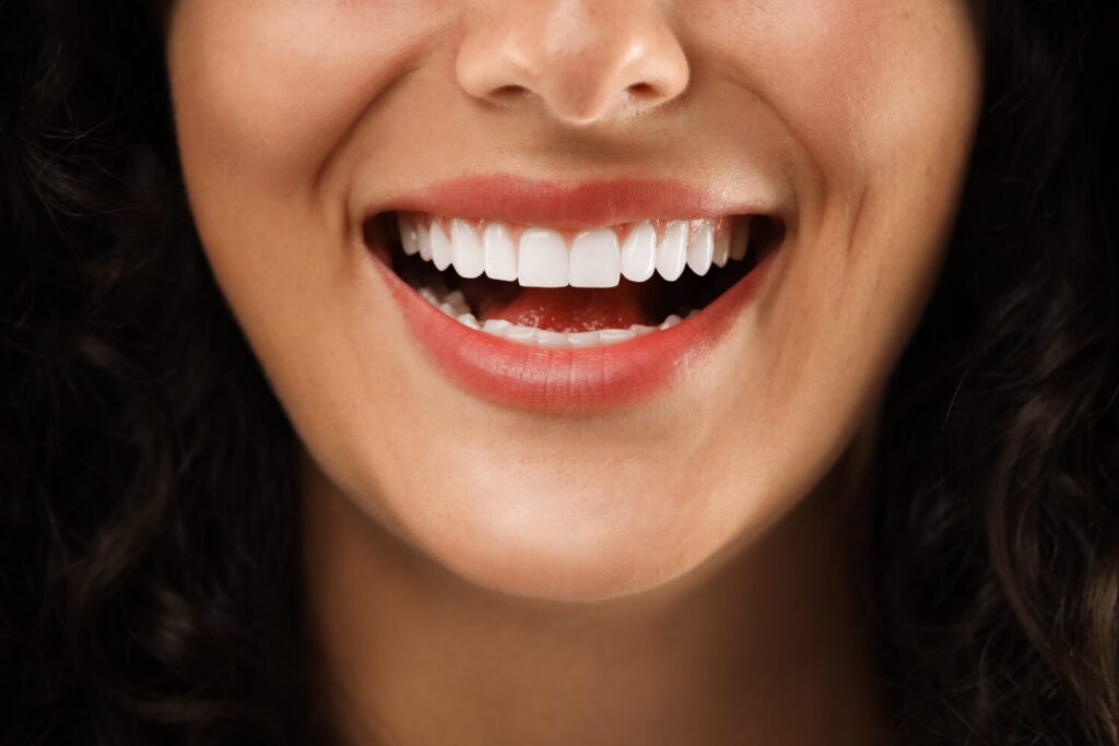 Sorriso Gengival Quando o Problema Está na Gengiva