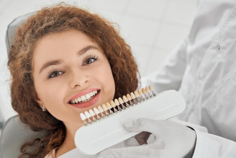 Paciente sorridente segura escala de cores VITA próxima aos dentes na Clínica Aoun, ilustrando a seleção de tonalidade para lentes de contato dental e preparação em dentes apinhados.